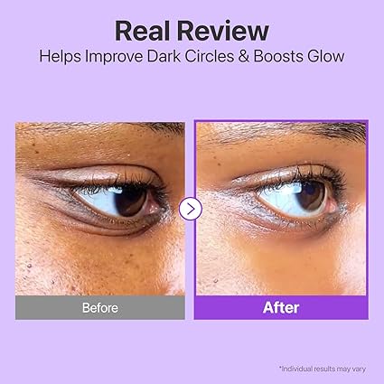 Numbuzin No.9 NAD+ Retinol Volumetox Eye Cream 10ml – Firming & Anti-Aging Eye Treatment - Image 4