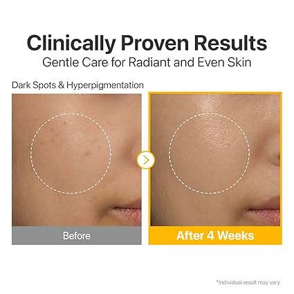 Numbuzin No.5 Vitamin Concentrated Serum 30ml - Image 2