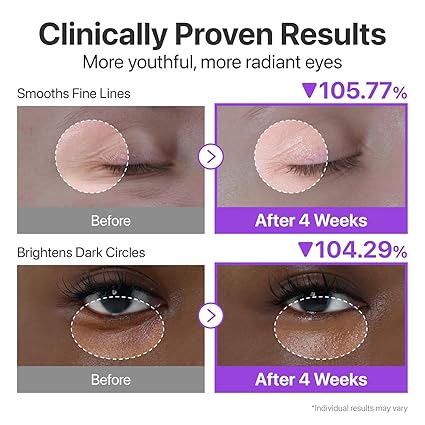 Numbuzin No.9 NAD+ Retinol Volumetox Eye Cream 10ml – Firming & Anti-Aging Eye Treatment - Image 3