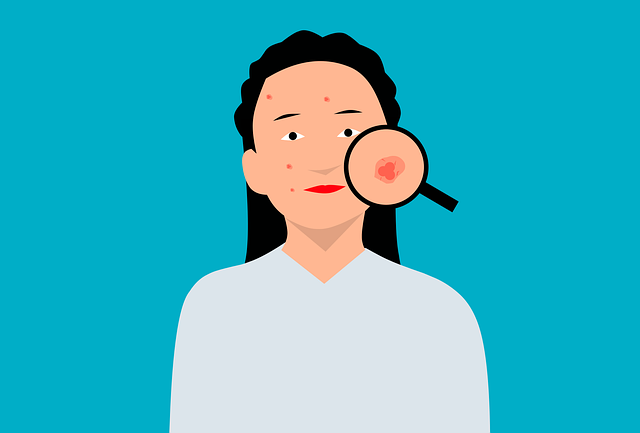 Tretinoin for Acne Scars